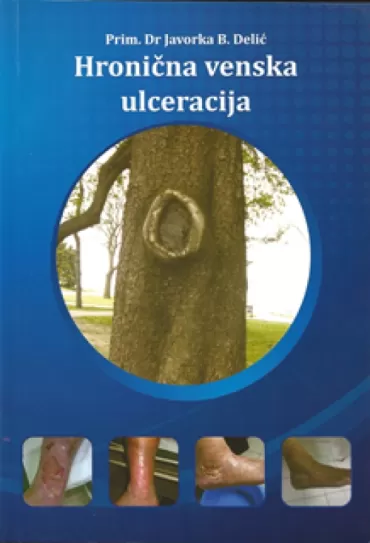 hronična venska ulceracija javorka b delić